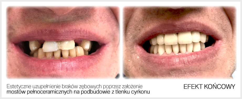 Klinika stomatologii estetycznej Śląsk