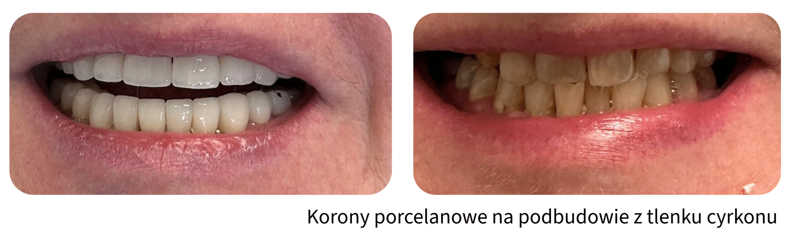 Metamorfozy uśmiechu Gliwice