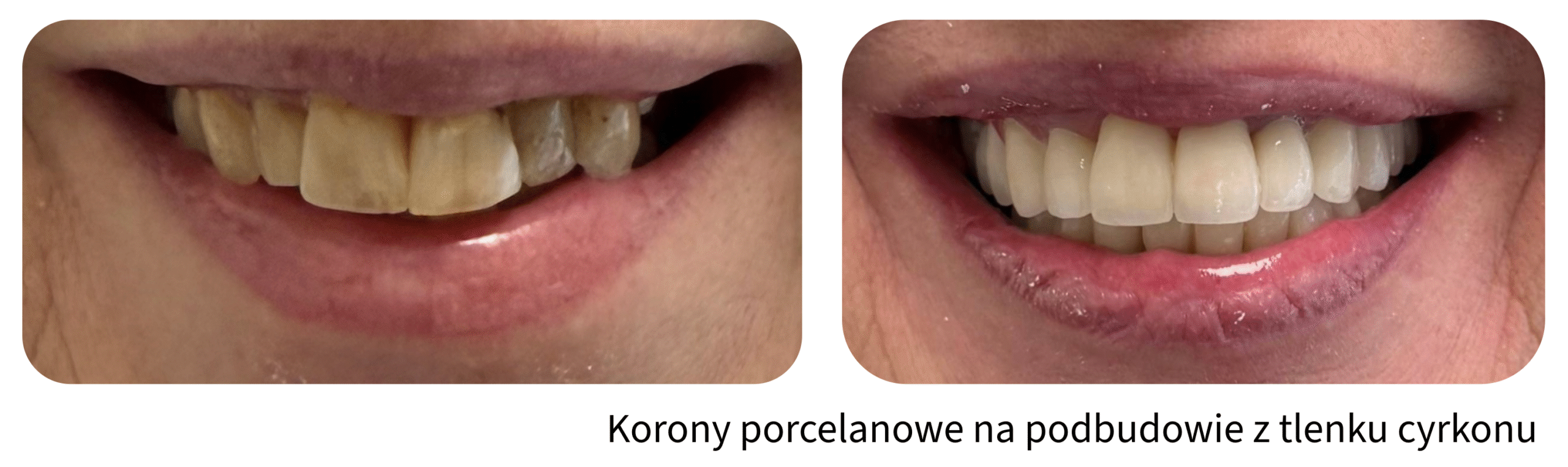 Metamorfozy uśmiechu Gliwice Śląsk