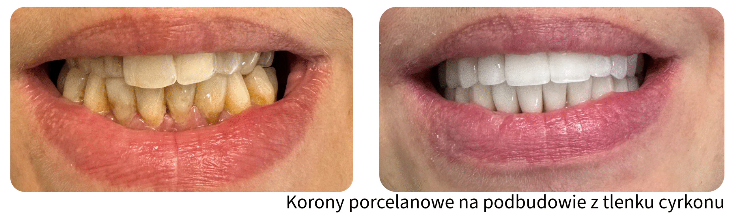 Metamorfozy uśmiechu Gliwice Śląsk