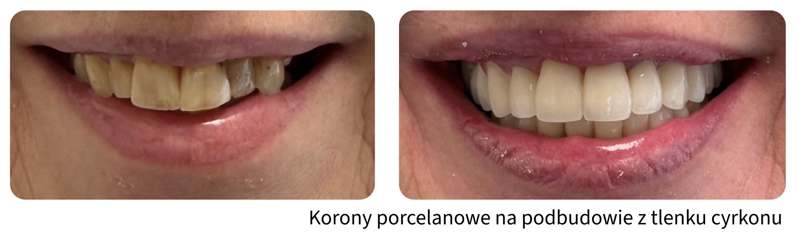 Metamorfozy uśmiechu