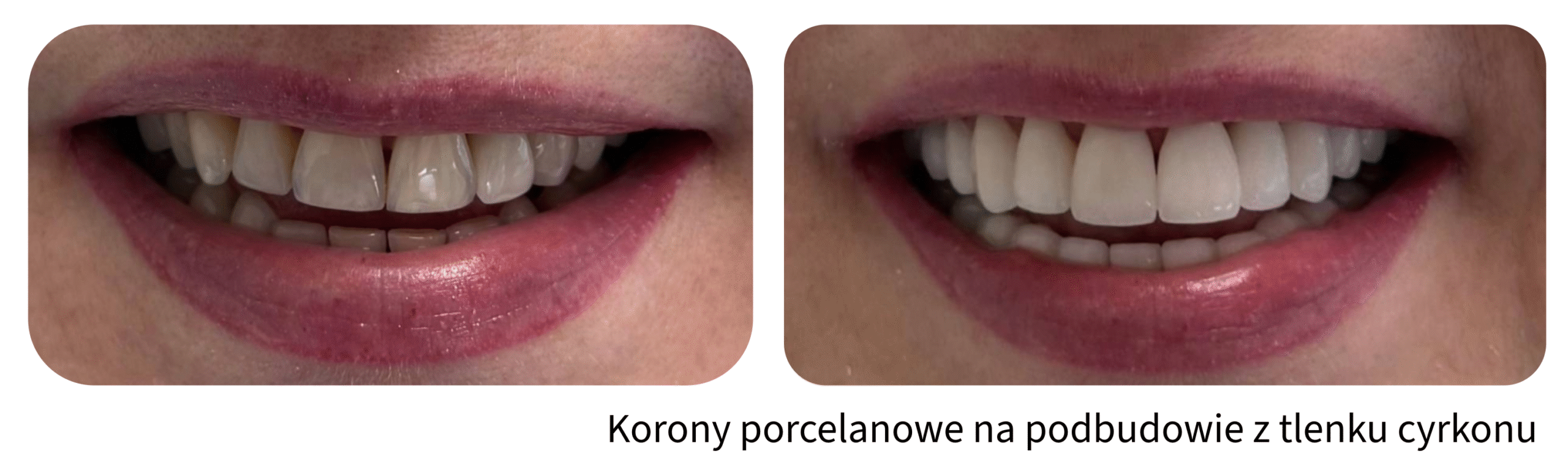 Metamorfozy uśmiechu Śląsk Katowice